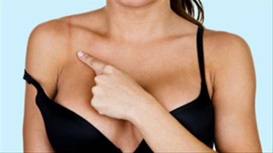 Cảnh báo: Sức khỏe chị em bị tổn hại vì áo lót nâng ngực