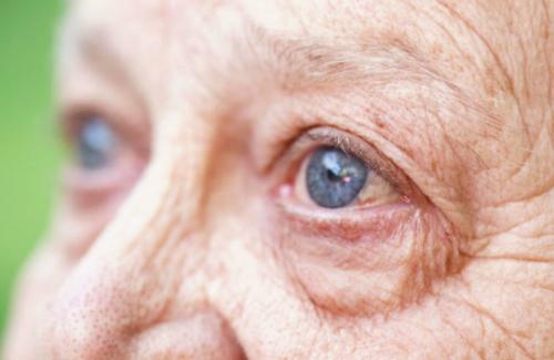 Bệnh thoái hóa hoàng điểm mắt ở người cao tuổi cần chú ý vấn đề gì?