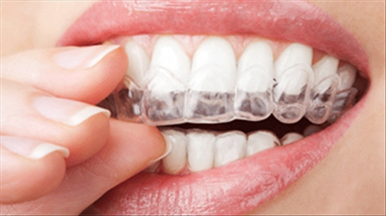 Tật nghiến răng và hậu quả nặng nề, bạn đã biết chưa?