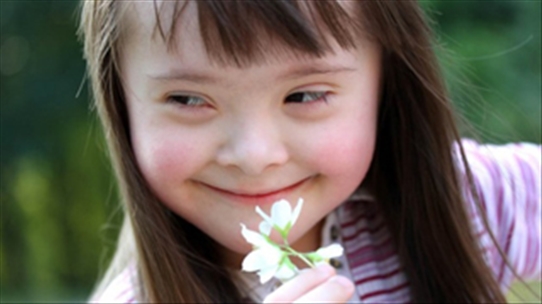 Trẻ mắc hội chứng Down: Xin hãy yêu thương nhiều hơn nữa