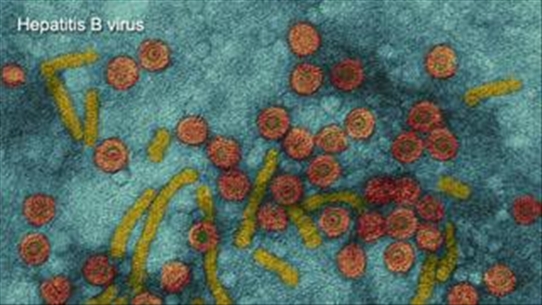 Không nên quá hoang mang khi nhiễm virus viêm gan B