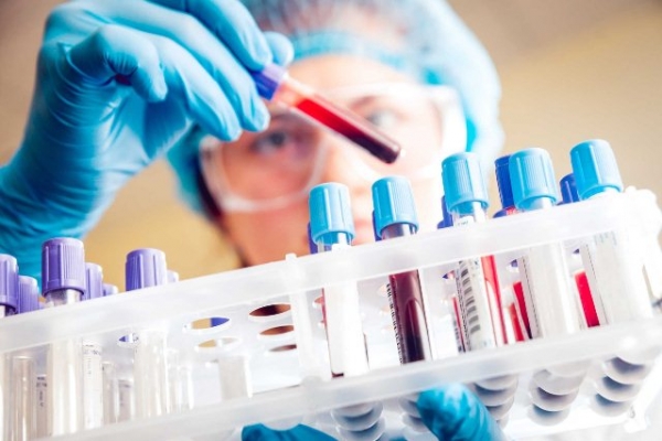 Xét nghiệm máu phát hiện ung thư có chính xác không?