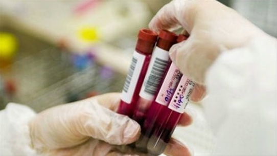 BS. Nguyễn Thị Thúy: Chỉ số SGPT phát hiện tổn thương ở tế bào gan