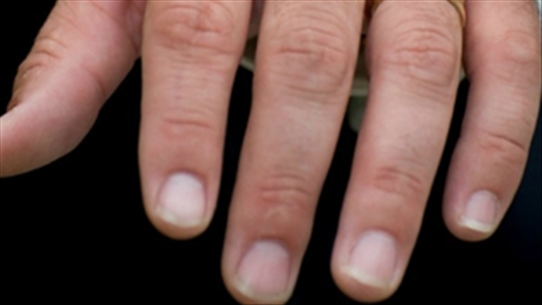 Bạn có biết tỷ lệ chiều dài ngón tay tiết lộ 5 bí mật của nam giới