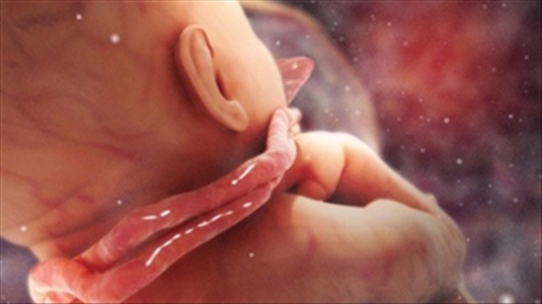 Sức khỏe sinh sản: Phải làm gì khi thai nhi bị dây rốn quấn cổ?