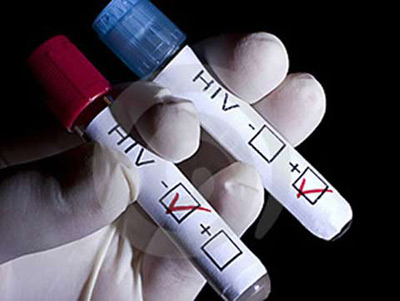 Mách nhỏ 7 dấu hiệu nhiễm HIV ban đầu ở nam giới có thể bạn chưa biết