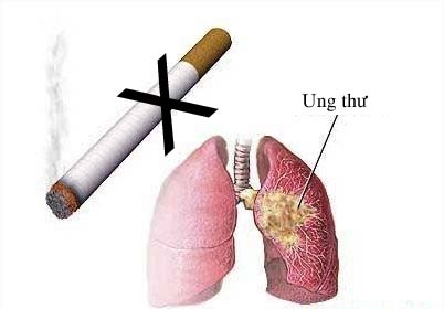 Đây chính là những bệnh ung thư hay gặp do khói thuốc ít ai ngờ đến