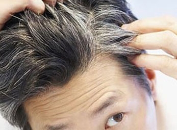 Món ăn - Thuốc ngăn ngừa bạc tóc theo y học cổ truyền