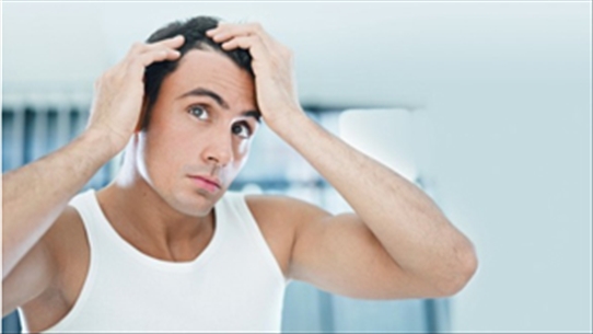 Bắt bệnh hói đầu ở nam giới: nguyên nhân và cách điều trị