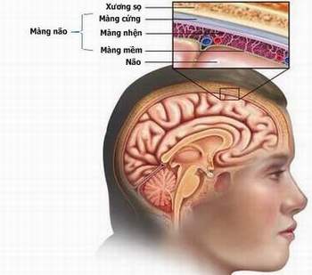 Nhận biết viêm màng não do não mô cầu là thủ phạm gây bệnh