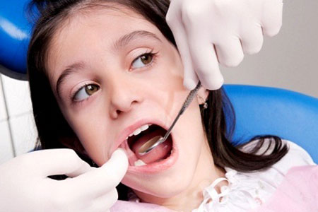 Những điều ít biết về sâu răng nên mọi người không được chủ quan