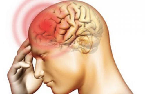 Thiểu năng tuần hoàn não: điều trị thế nào cho hiệu quả?