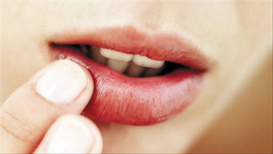 Viêm môi bong vảy: Trị có khó không và có để lại sẹo không?