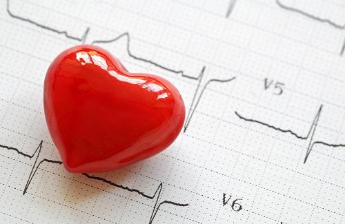 Bệnh tim đập nhanh - Nguyên nhân và hướng điều trị