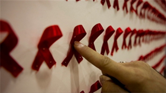 Bệnh nhân HIV chịu ít nguy cơ mắc bệnh đa xơ cứng - Bạn có biết?