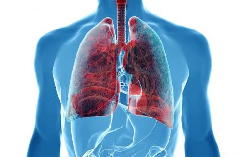 Ung thư phổi giai đoạn 4 - Những dấu hiệu cùng biểu hiện