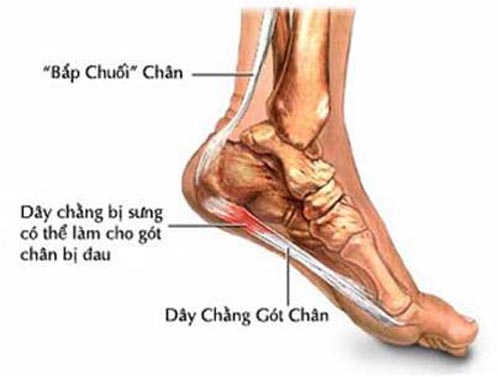 Tìm hiểu về các bệnh gây đau gót chân và thuốc trị