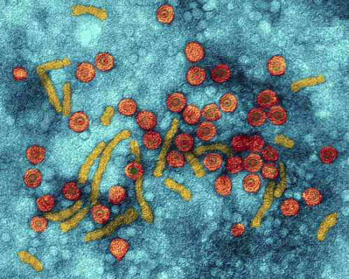 Những mối hiểm họa nguy hiểm từ bệnh viêm gan virut