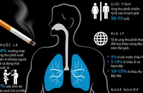 Nguyên nhân gây ung thư phổi - Biết để phòng ngừa từ xa