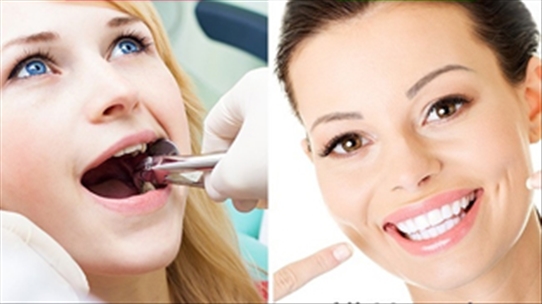 9 quan niệm sai lầm về răng miệng nhiều người vẫn tin - Đây là sự thật