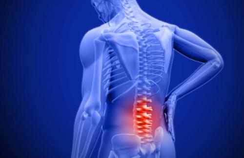 Hạn chế đau lưng do sai tư thế bằng cách nào? Bạn đã biết phương pháp nào rồi?