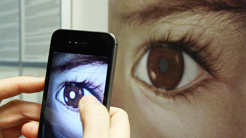 Chuyên gia mách cách nhận biết bệnh của con qua đôi mắt