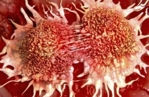 Tiến hành ghép tế bào gốc thành công cho ca bệnh ung thư máu nguy hiểm