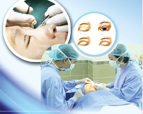 Phẫu thuật mí mắt: Không cẩn thận coi chừng thành thảm họa