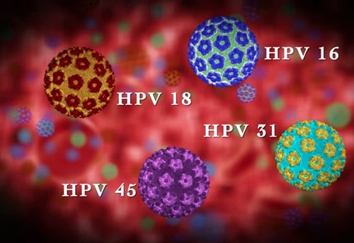 Cảnh báo gia tăng tỷ lệ nam giới mắc ung thư vòm họng do HPV