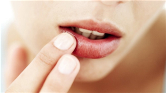 Bắt bệnh qua màu sắc của đôi môi có thể bạn chưa biết