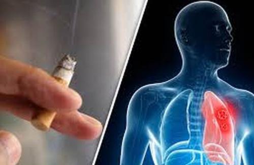 Triệu chứng của ung thư phổi giữa người hút thuốc với người không hút thuốc