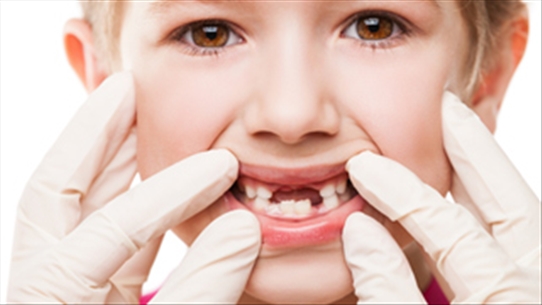 Làm sao để bé không bị sún răng bạn có biết không?