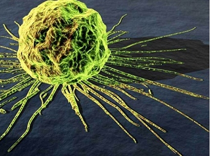 Tìm hiểu về bệnh ung thư: Căn bệnh có từ thời cổ đại?