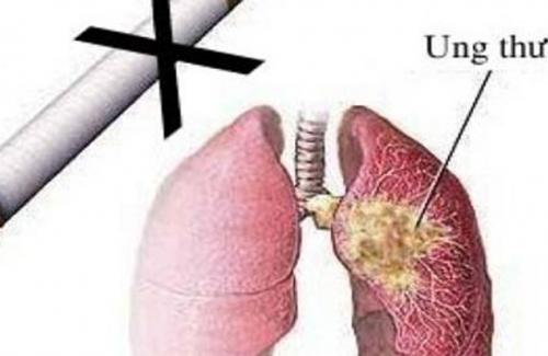 Mối quan hệ nguy hiểm giữa hút thuốc và bệnh ung thư