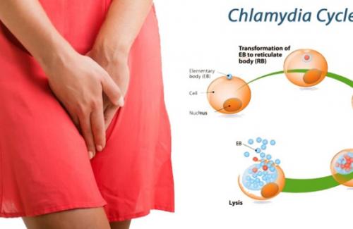 Tầm quan trọng trong việc phát hiện sớm căn bệnh Chlamydia