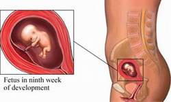 Phụ nữ mang thai và mắc bệnh Rubella, chớ nên coi thường