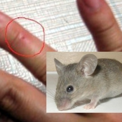 Cảnh báo từ chuyên gia: Đừng để mang bệnh vì không để ý vết chuột cắn