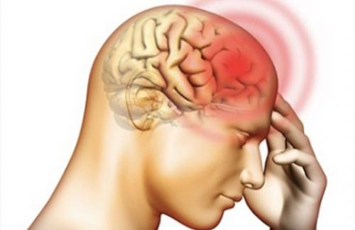 Những triệu chứng viêm màng não thường gặp nhất theo từng nguyên nhân
