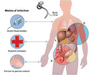 Bệnh Ebola: Hướng dẫn chẩn đoán và những hướng điều trị