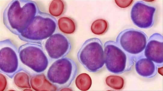 BSCKII Vũ Thị Lừu: Các biểu hiện của bệnh u máu là những gì?