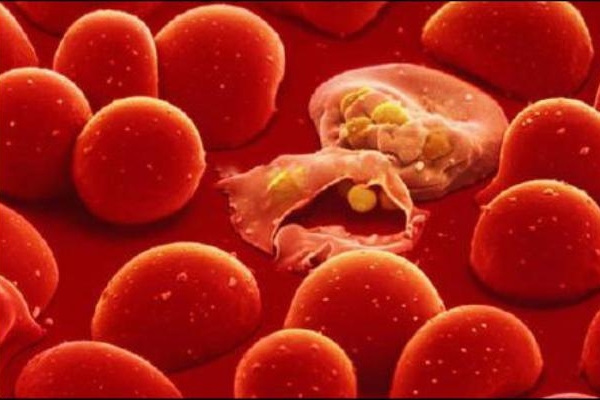 Bệnh Thalassemia và cách trị như thế nào thì hiệu quả?