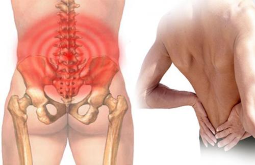 Bị đau lưng có thể là dấu hiệu của những căn bệnh nguy hiểm nào?