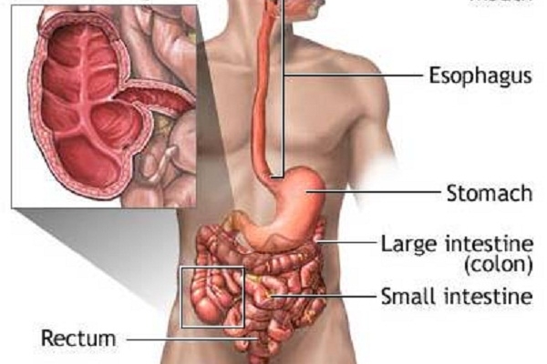 Phát hiện mới về ảnh hưởng của bệnh Crohn lên não là gì?