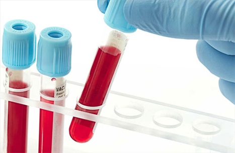 Sức khỏe: Nguy cơ mắc bệnh của từng nhóm máu là những gì?