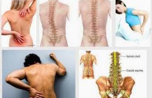 Điều trị đau thắt lưng nhanh nhất bằng những liệu pháp đơn giản