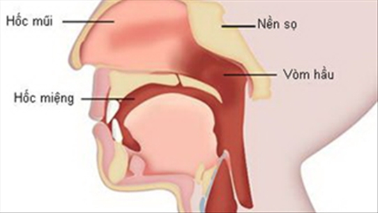 Phác họa điều trị bệnh ung thư vòm họng từng giai đoạn