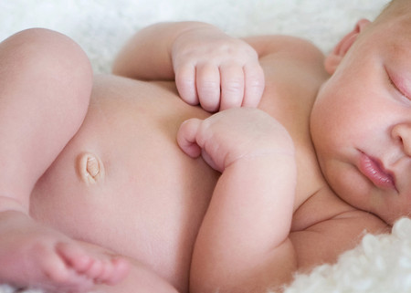 Bệnh lý về rốn ở trẻ sơ sinh, cha mẹ nên chú ý để phòng bệnh cho trẻ