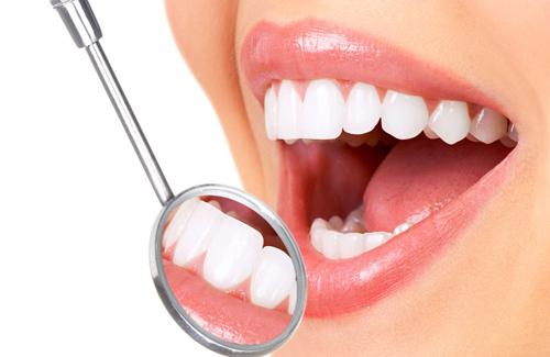 Cao răng là gì? Tại sao bạn phải thường xuyên làm sạch cao răng?