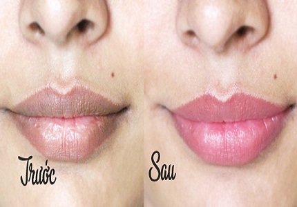Cách trị thâm môi giúp môi căng mọng trong tích tắc bạn đã biết chưa?