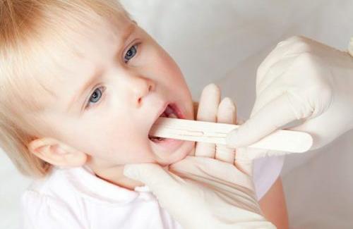 Những triệu chứng viêm họng ở trẻ em thường gặp nhất